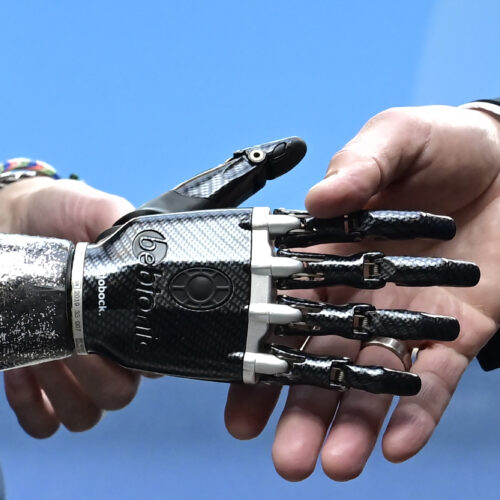 How 3D printing is personalizing health care