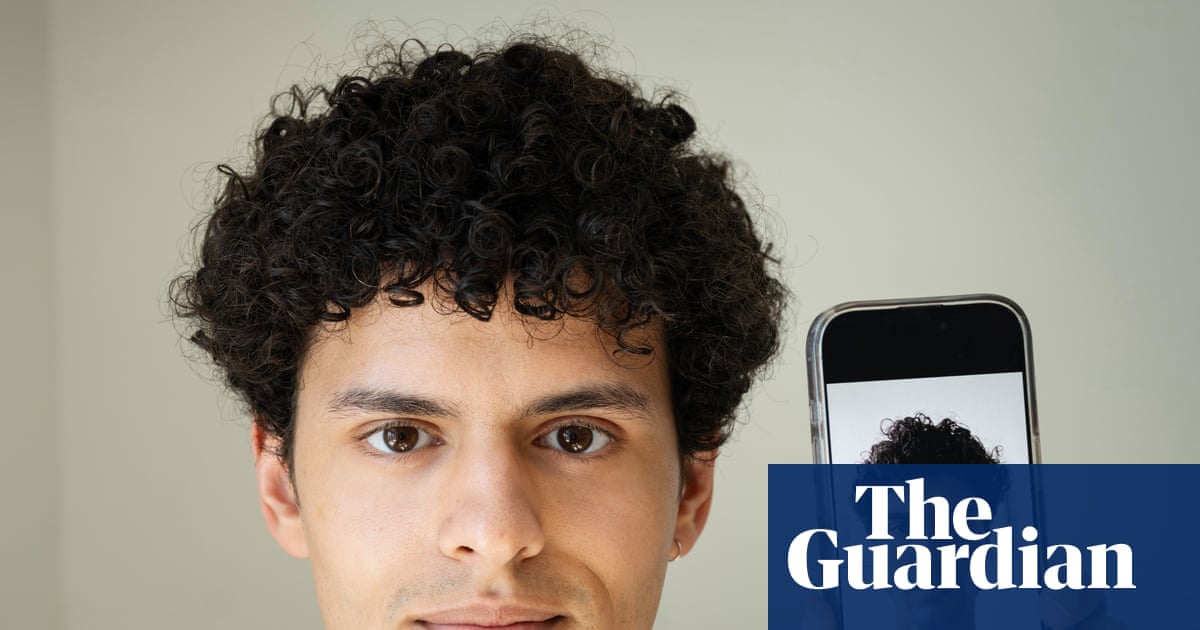 Rise in plastic surgeons asked to create ‘AI face’…