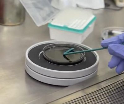 Upper East Side Legionnaires’ outbreak grows to nearly two dozen cases
