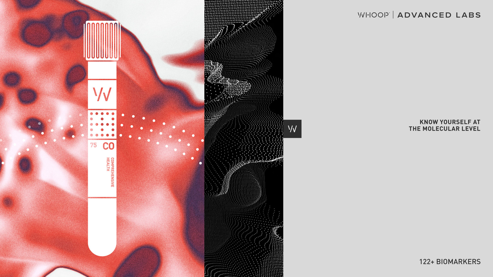 Whoop’s Advanced Labs health screenings will no longer require a subscription