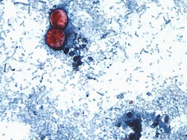 Cyclospora outbreak followed years of declining FDA foreign inspections